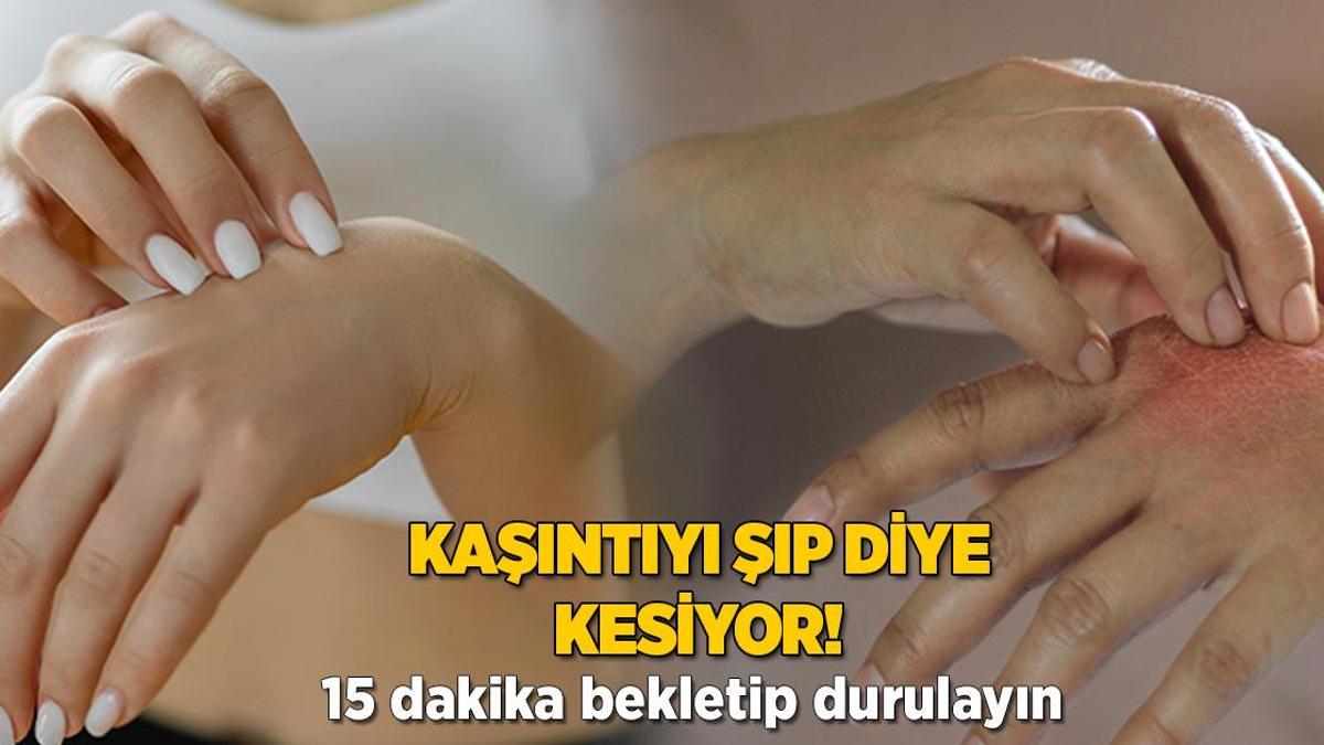 Kaşıntıyı şıp diye alıyor! 15 dakika bekletip durulayın, eller ferahlayacak